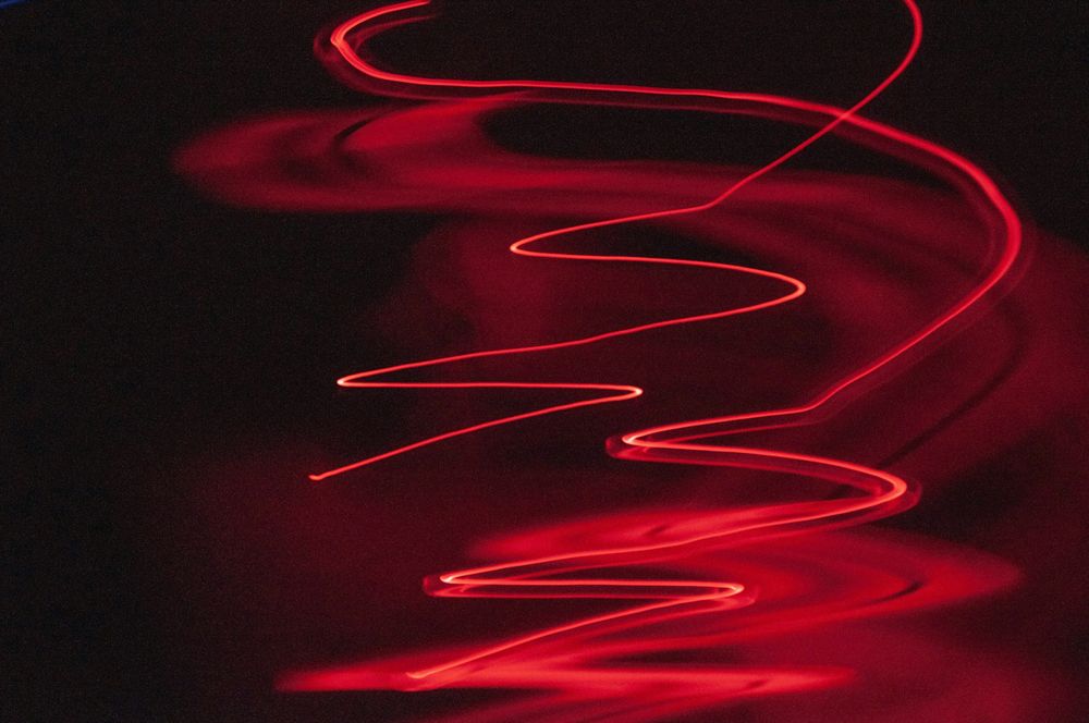 Why You Shouldn't Use Lasers to Play with Your Dog